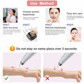 Blackhead Remover Pore Vacuum Cleaner Pimple Extractor - Facial Pore Cleaner Pore Extractor - Electric USB Pore Vacuum with 5 Probes - Blackhead Suction Tool - Blackhead Remover Kit (White)