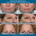 Rapid Reduction Eye Serum - Advanced Formula anti Aging Visibly Reduces Under-Eye Bags, Wrinkles, Dark Circles, Fine Lines & Crow'S Feet Instantly Instant Wrinkle Remover for Face