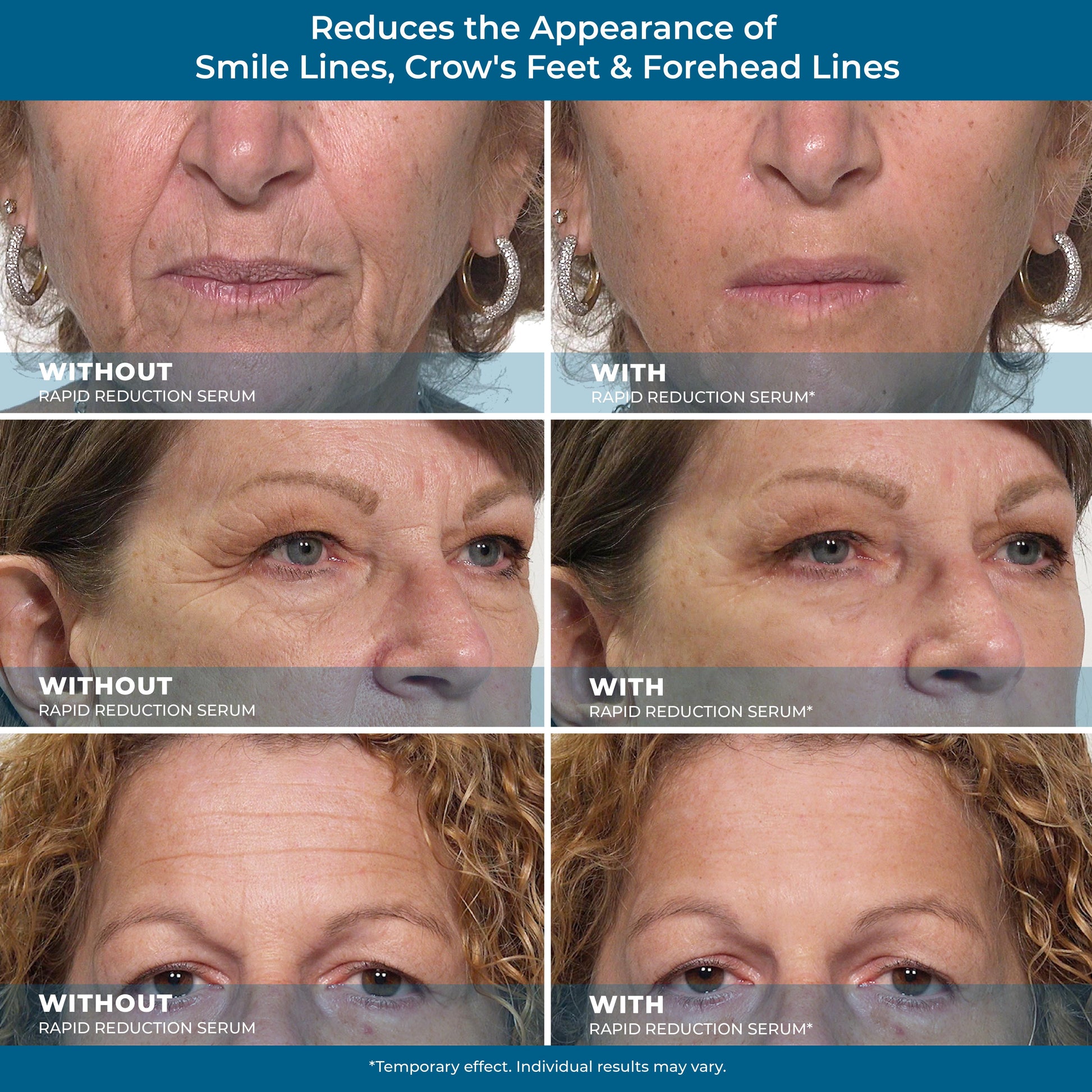 Rapid Reduction Eye Serum - Advanced Formula anti Aging Visibly Reduces Under-Eye Bags, Wrinkles, Dark Circles, Fine Lines & Crow'S Feet Instantly Instant Wrinkle Remover for Face